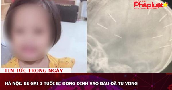 Chuỗi truyền thông Bảo vệ Quyền phụ nữ& Trẻ em: Bé gái 3 tuổi bị đóng đinh vào đầu đã tử vong