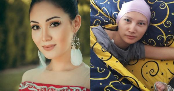 Mới hơn 20 xuân sanh nhưng Hoa hậu Kyrgyzstan phải qua đời vì ung thư xương