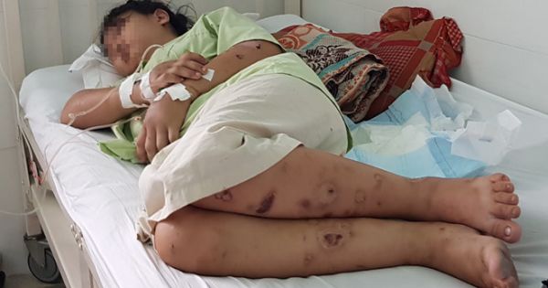 Vụ cô gái 18 tuổi bị đánh đến sẩy thai: Bắt nghi phạm cuối cùng