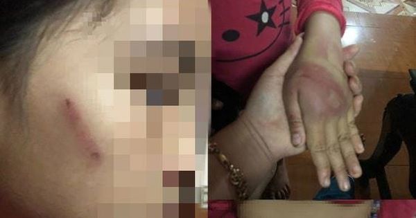 Chuỗi truyền thông Bảo vệ Quyền phụ nữ& Trẻ em: Bé gái 8 tuổi bị bố bạo hành ở Thanh Hóa: Xử phạt hành chính 2,5 triệu đồng