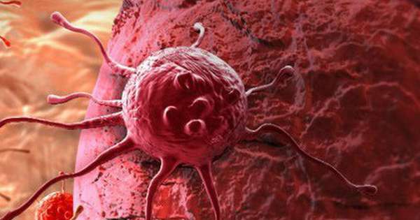 Những lí do khiến tế bào ung thư lan nhanh bất thường