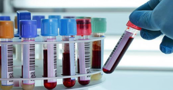Việt Nam sẽ nghiên cứu dùng huyết tương điều trị bệnh nhân Covid-19