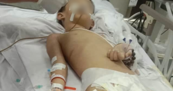 Bình Phước: Điều tra vụ cháu bé 7 tuổi tử vong sau khi mổ tháo đinh nẹp tay