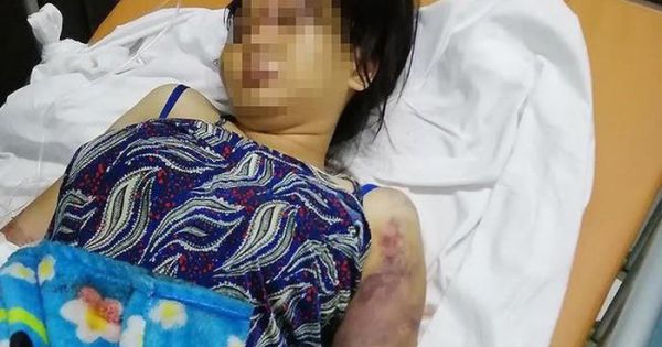 Truy tố 3 người tra tấn cô gái đến sẩy thai ở Bình Chánh