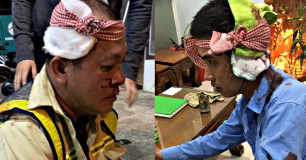 Điều tra vụ 2 nhân viên Trạm BOT Ninh Xuân bị đánh nhập viện