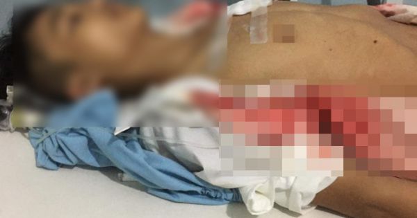 Nam sinh bị bạn đâm thấu ngực ngay trước cổng trường ở Hà Giang
