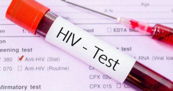 Giảm độ tuổi tự nguyện xét nghiệm HIV/AIDS xuống đủ 15 tuổi