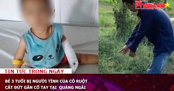 Bé 3 tuổi bị người tình của cô ruột cắt đứt gân cổ tay tại Quảng Ngãi
