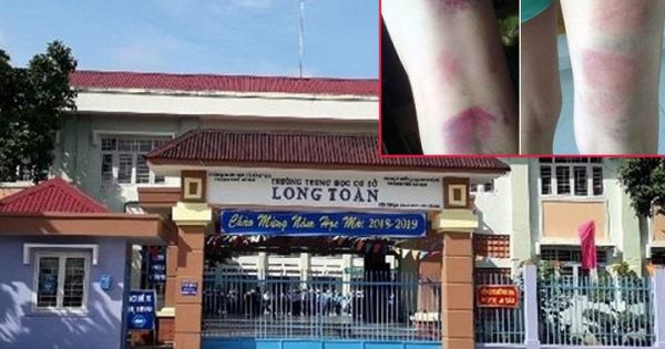 Bộ GD-ĐT vào cuộc vụ giáo viên đánh tím chân 22 học sinh ở Vũng Tàu