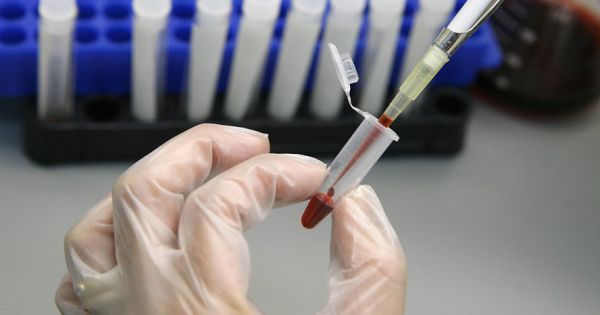 Bệnh nhân thứ 3 trên thế giới chữa khỏi HIV mà không cần ghép tủy xương